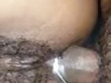 back side 