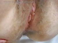 Hairy Mature