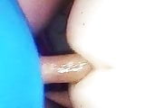 anal